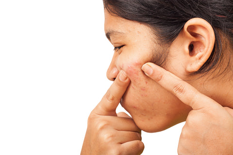 woman treating acne on face
