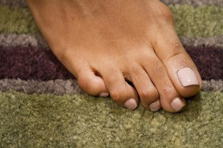 foot with corns and calluses