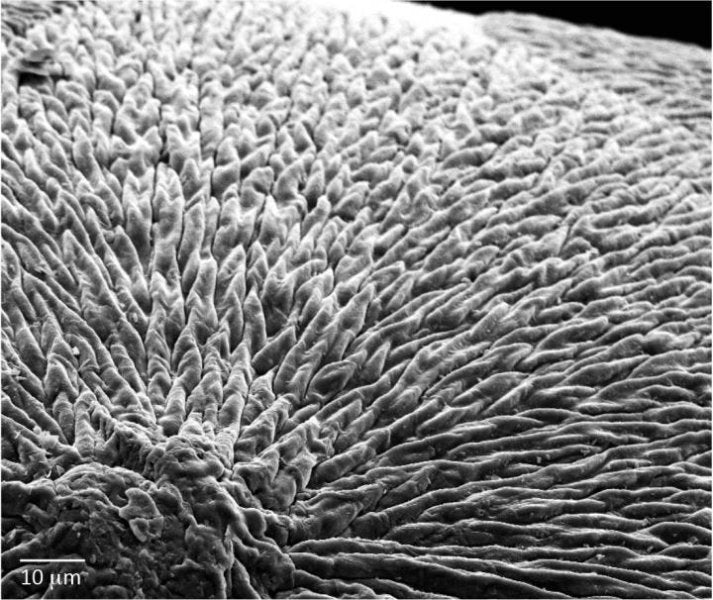 Study: Can A New Material Regenerate Dental Enamel?