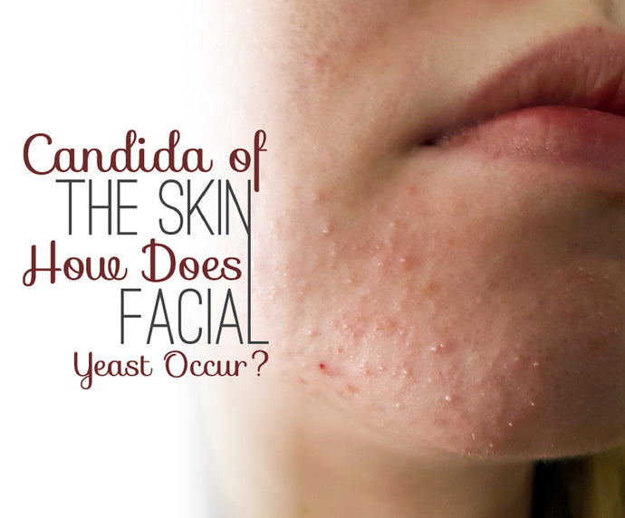Candida Of The Skin: How Does Facial Yeast Occur?