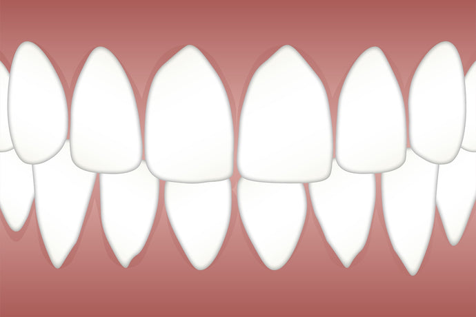 Gum Disease - Causes, Symptoms, Diagnosis And Treatments