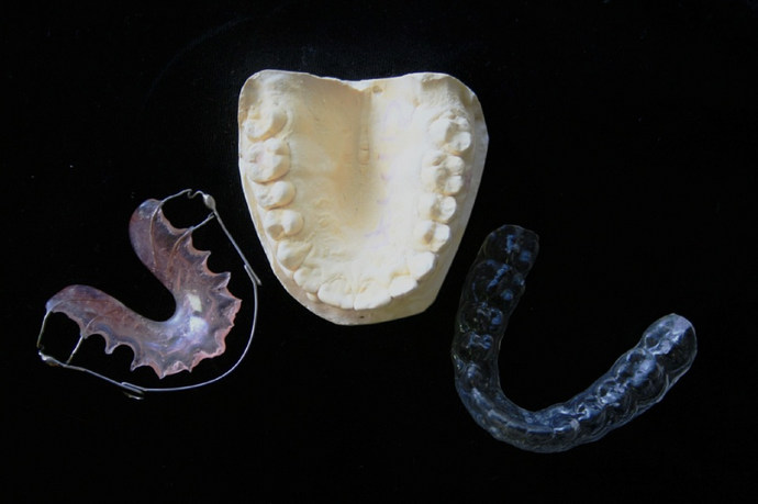 How Can Removable Aligners Be Healthier For Teeth Than Metal Braces?