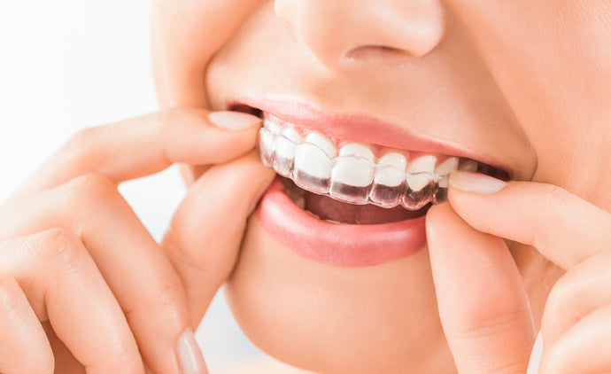 All You Need To Know About The Benefits Of Invisalign