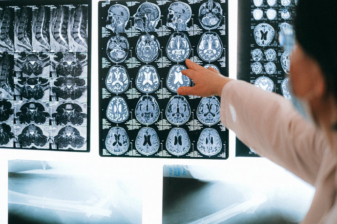 X-Ray, CT, And MRIs: What Kind Of Medical Imaging Do You Need?