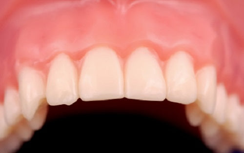 If Your Gums Were Bleeding What Would You Do?