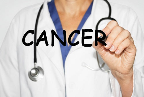 Study: Link Between Oral Cavity Cancer And Lymph Node Ratio