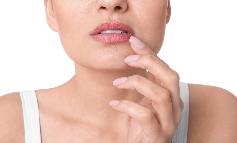 Canker Sores: An Irritating Nuisance