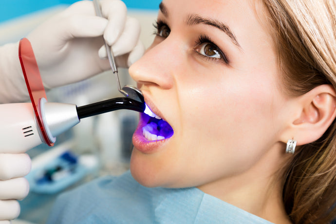 Cavities – How To Prevent Them And What To Do If You Have Them
