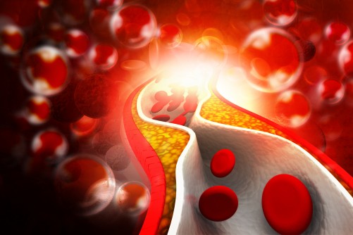 5 Key Steps To Keep Your Cholesterol In Check