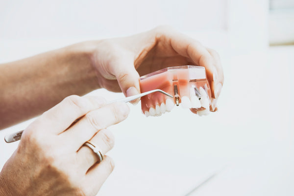 dentist explaining dental implant surfaces