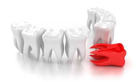 Can Tooth Loss Indicate Malnutrition?