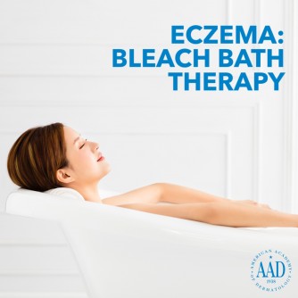 woman taking eczema bleach bath