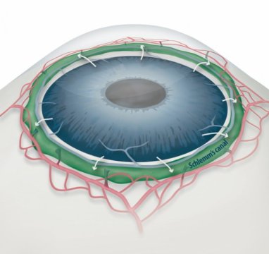 The Need To Understand Glaucoma