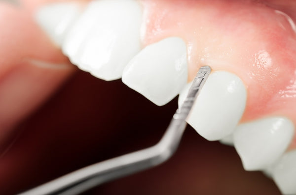 close up of dental procedure for oral healthcare