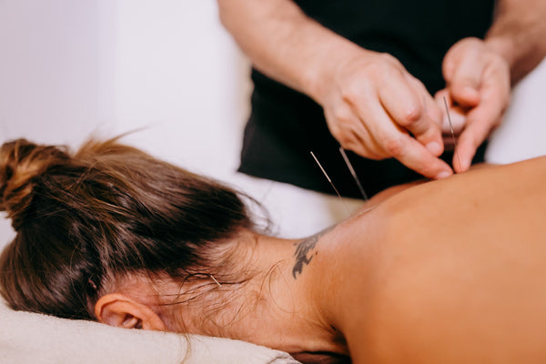 woman receiving holistic healing acupuncture