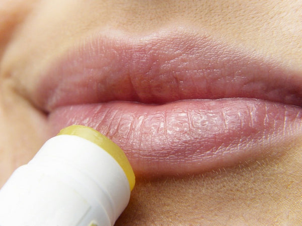 Remedies For Dry And Chapped Lips