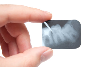 Loose Teeth: What Causes Them?
