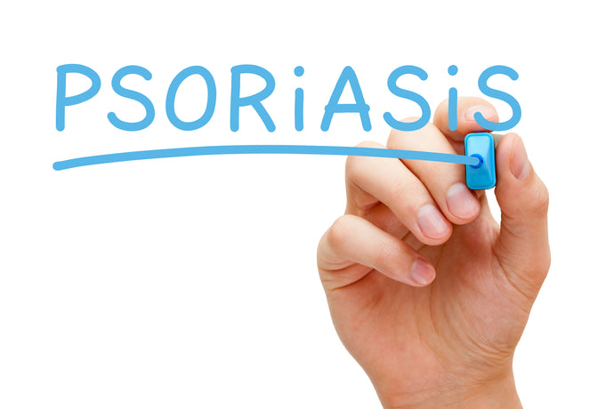 What Triggers Psoriasis?