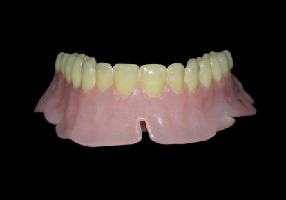 How To Stop Receding Gums