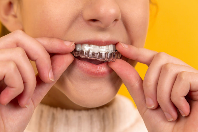 Invisalign Vs. Retainer: Which Is The Best Option For You