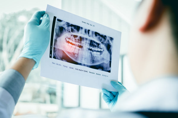 dentist studying X-ray for soft tooth problems