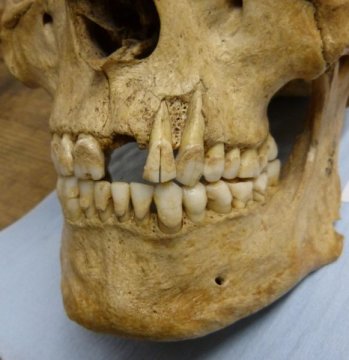 Tooth Talk: How  Teeth Evolved Into ‘Ultimate Cutting Tools’