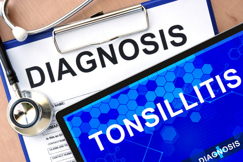 Tonsil Stones: What Are They And What Can You Do About Them?