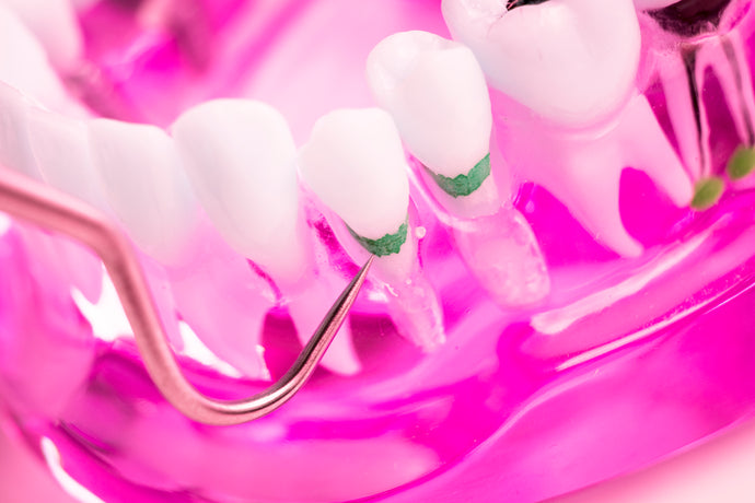 Preventing And Healing Tooth Decay With Bioactive Peptide
