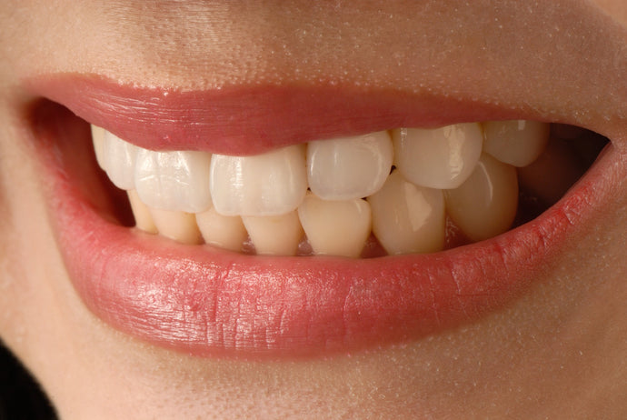 Veneers – What to Know