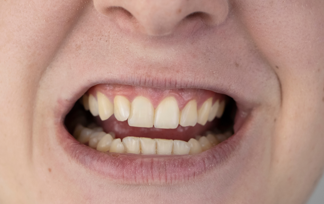 Toothpaste Alternative