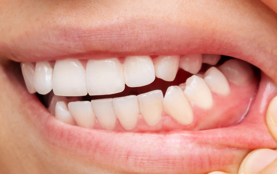 Toothpaste Alternative